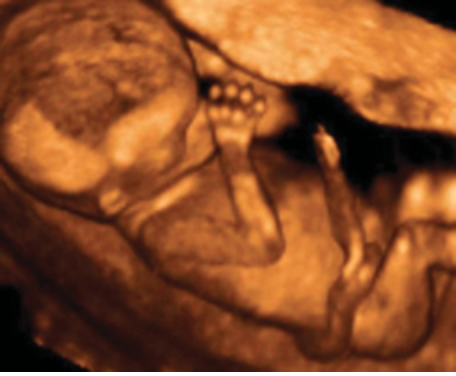 cybermom1999's tweet photo. This is a 4d ultrasound of an actual, living human being estimated to be at 14 weeks, 5 days pregnancy.  #prolife #prochoice #DobbsDecision https://t.co/7lRQ69mHdC