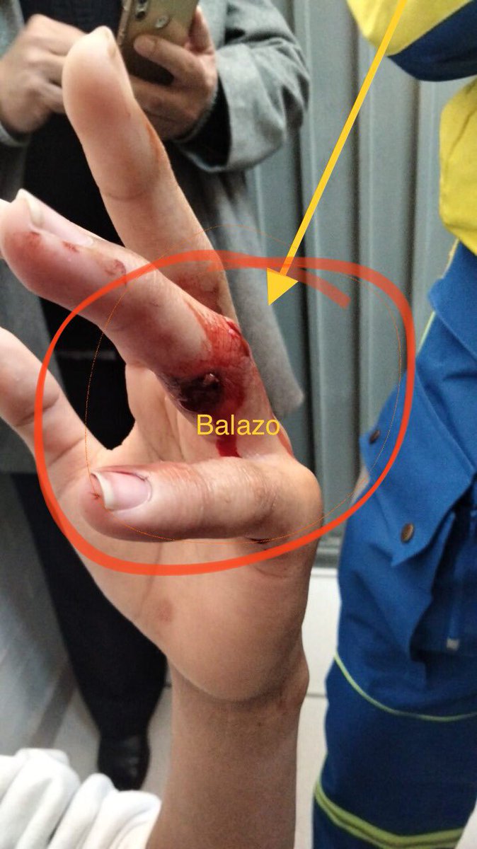 jcsanchezamaya's tweet photo. Hoy un estudiante de 12 años en Iztapalapa ingresa a la secundaria Diurna N° 79 "República de Chile" con una escuadra .9mm y dispara. Él resulta lesionado en un dedo. Por acciones cómo está, muchos alumnos y maestros han perdido la vida… https://t.co/1e1RgnqPQg