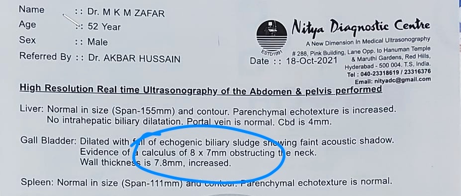 drmkmzafar's tweet photo. Got rid of GB stone (7×8mm), thanks to Dr. Iftekharuddin R/o Sangareddy T.S. Allopathy suggests 2 remove GB, but by Homeo &amp; Herbal remedies he dissolved stone &amp; am feeling free from over Wt, Indigestion, Gastric n acidity. May Allah heal many through him &amp; reward him best, Ameen. https://t.co/bTSMVQTaBl