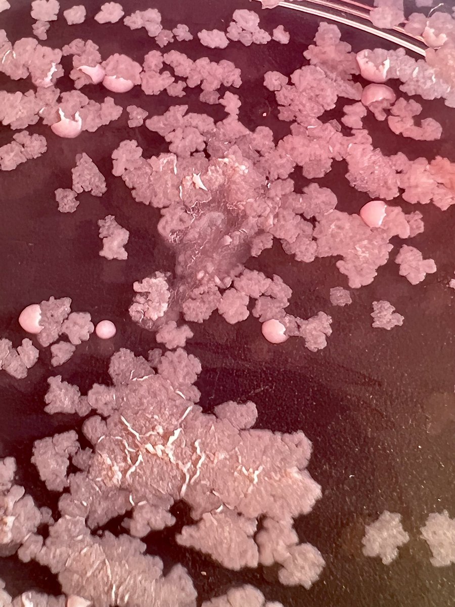 #BacterioMed Cohabitation of the 2 Mycobacterium abscessus morphotypes, Rough (majority) and Smooth, in a #CysticFibrosis sputum bacterial culture. 
Usefulness of prolonged incubation of Cepacia medium. #IDtwitter #NonTuberculousMycobacteria