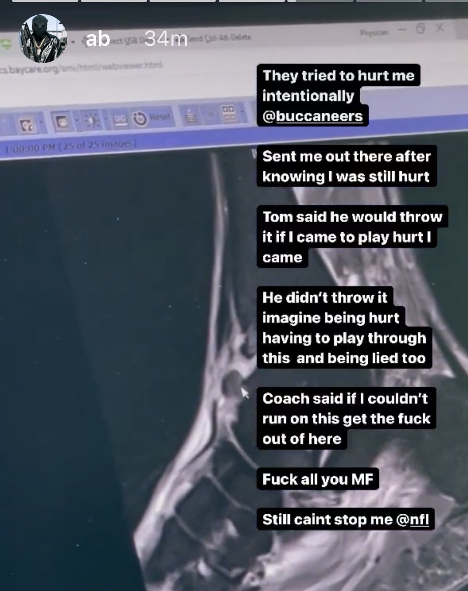 Seven weeks after he left Bucs mid game, Antonio Brown posts this with an x-ray of his ankle today on Instagram. He had five targets in first half of the Jets game, one off the team high.