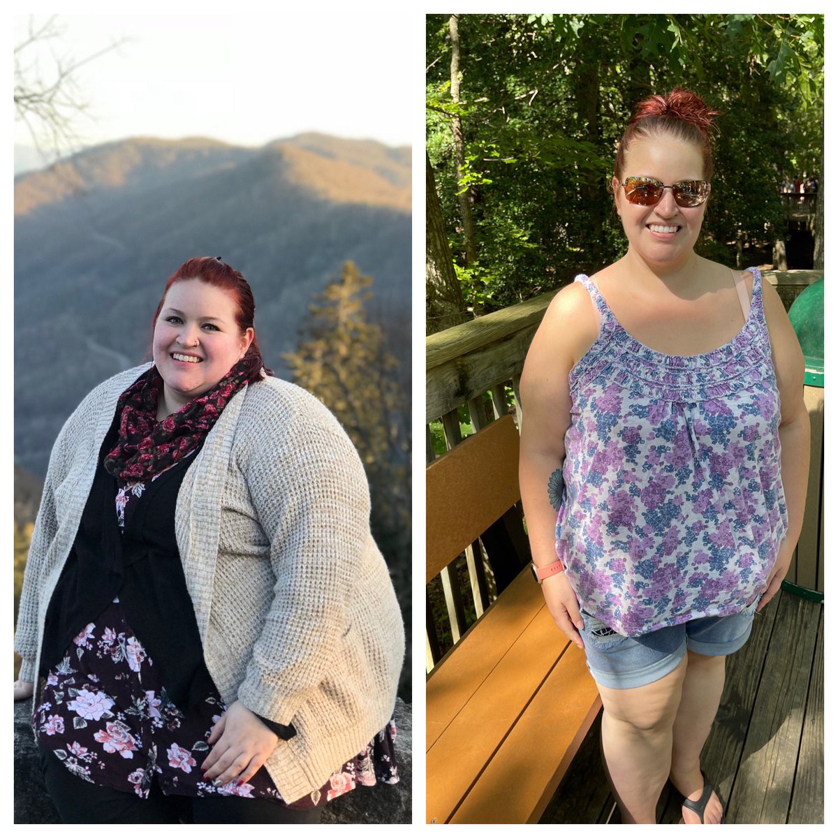 At her heaviest, Pennsville’s Kim Rivera weighed nearly 400 pounds. Since bariatric sleeve gastrectomy surgery with Dr. Harish Kakkilaya, she has lost 160 pounds and continues to lose. Read about her journey here smc.health/a-sons-motivat…