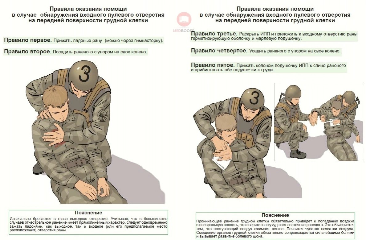 Первая помощт при агнестрельном ранени. Пмп при огнестрельных ранениях. Оказание помощи при огнестрельном ранении. Первая помощь при пулевых ранениях конечностей. Первая помощь при огнестрельном ранении.