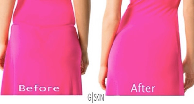 skinForma's tweet photo. No More Panty Lines 💃
Check out our GSkins at https://t.co/fqZTADfPOQ

#panty #perfectfit #nopantylines #GSkin #skinForma #panties #animalprints #skintone #skintonecolors 

https://t.co/3TgMqJ05rw https://t.co/k5s3szEbgd