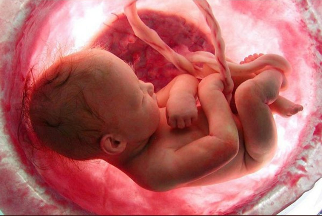 RICHENAO's tweet photo. Un niño de 6 meses. No se que celebran, la legalidad de la pena de muerte a un inocente e indefenso? https://t.co/Czzioo5HAg