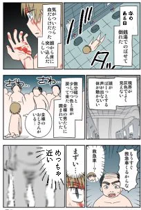 銭湯で倒れてアゴをやられた話 