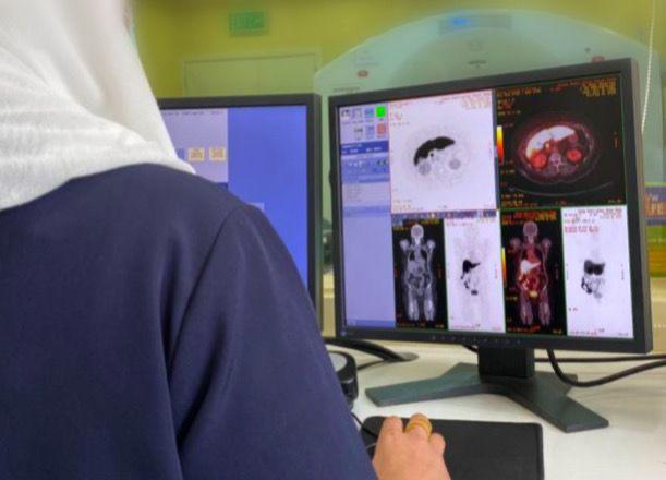 aladan_nm's tweet photo. تم اضافة فحص ال F18- FES كخدمة جديدة في مجال التشخيص البوزيتروني  لمرضى سرطان الثدي بمستشفى العدان .
بحيث تكمن اهمية الفحص بالكشف عن مدى استجابة المريض للعلاج الهرموني وذلك عن طريق حقن مادة FES بالوريد. 
وقد تم  عمل اول فحص في الوحدة من قبل الاختصاصية سارة والاختصاصي بانير. https://t.co/olJvWlzB9o