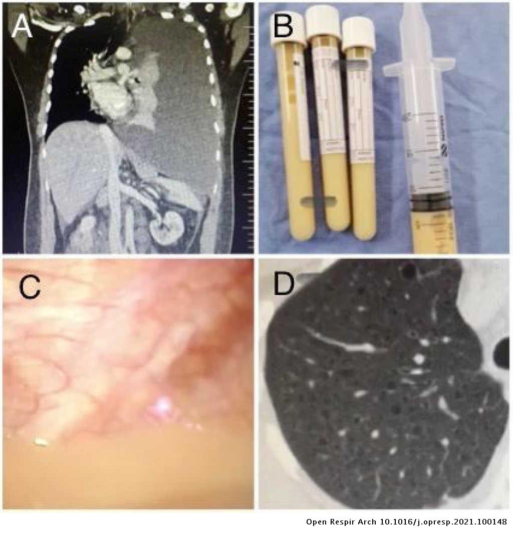 Open Respiratory Archives tweet media