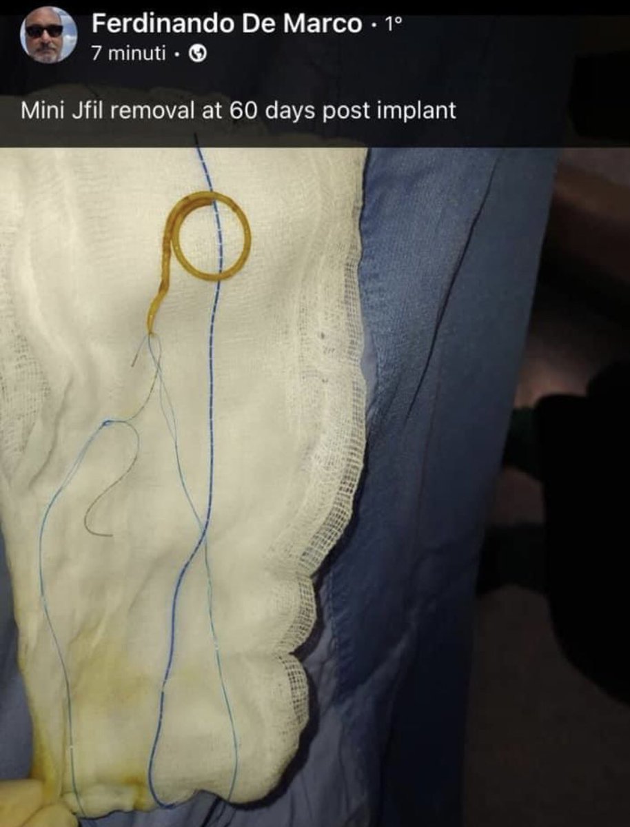 rocamed's tweet photo. #MiniJFil #NoPain #Qualityoflife https://t.co/t6nWfI8Lae