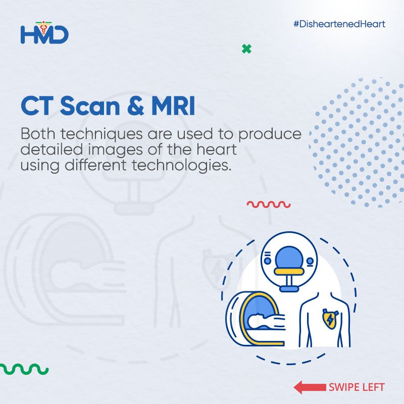 hmdhealthcare's tweet photo. Routine heart check-ups can help you diagnose underlying heart conditions & get the right treatment. Doctors may recommend different medical tests to determine the nature of your heart conditions. Some of these tests are explained here. #HeartCheckup #HeartConditions #HeartTech https://t.co/ZLQt1xN4Af