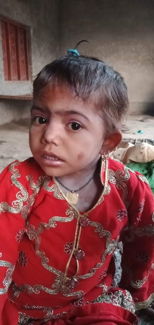 sultanrind24's tweet photo. دو تصویروں میں پورا سندھ ہے😭😭
ایک طرف سکھر کے معصوم جشپال کمار کی ھی تشدد شدہ لاش ہے جو بیمار سماج کی ننگی درندگی کی عکاسی کر رھا ہے!
دوسری طرف شکارپور کے گائوں جیئاپور میں تھیلیسیما سے جان دینے والی ننی منی بچی طوطاں کی بے بسی والی تصویر😭😭 https://t.co/lTWjYRmOXP https://t.co/UehXS4pJEq