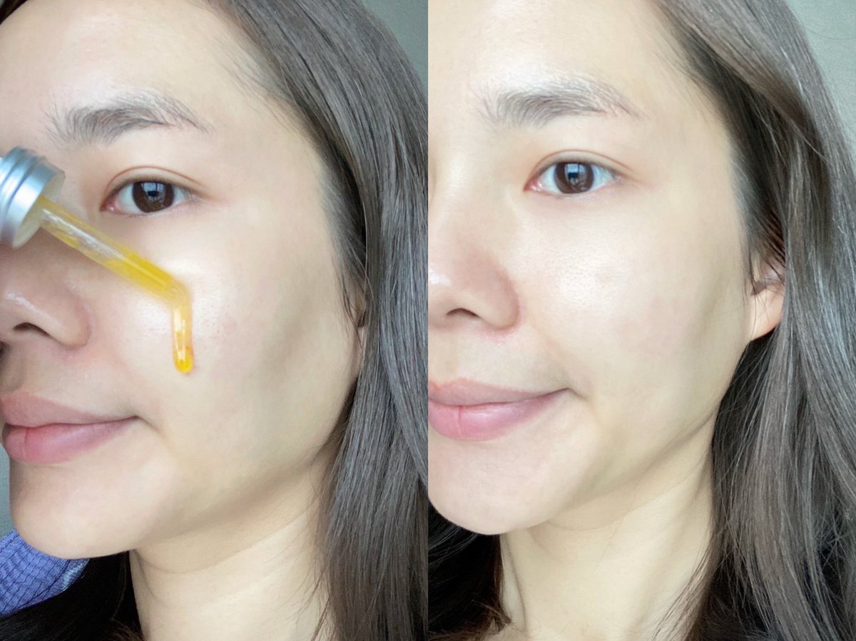 kkaungkwan's tweet photo. เซรั่มวิตามินรวมของ Fresh ตัวนี้ ปังนะซิส !!! เนื้อเซรั่มเข้มข้นมาก เป็นอาหารผิวที่ดีเลยอะ ใช้แล้วผิวกระจ่างใส อิ่มฟู แล้วก็ดูเรียบเนียนขึ้นด้วย เค้าเคลมว่ามีเทคโนโลยีที่จะช่วยให้ได้รับสารอาหารและวิตามินที่สดใหม่ทุกครั้งเมื่อใช้ เป็นเซรั่มอีกตัวที่ควรมี #MyFreshBoost #FreshLoveTH https://t.co/pgMRNUwI8Q