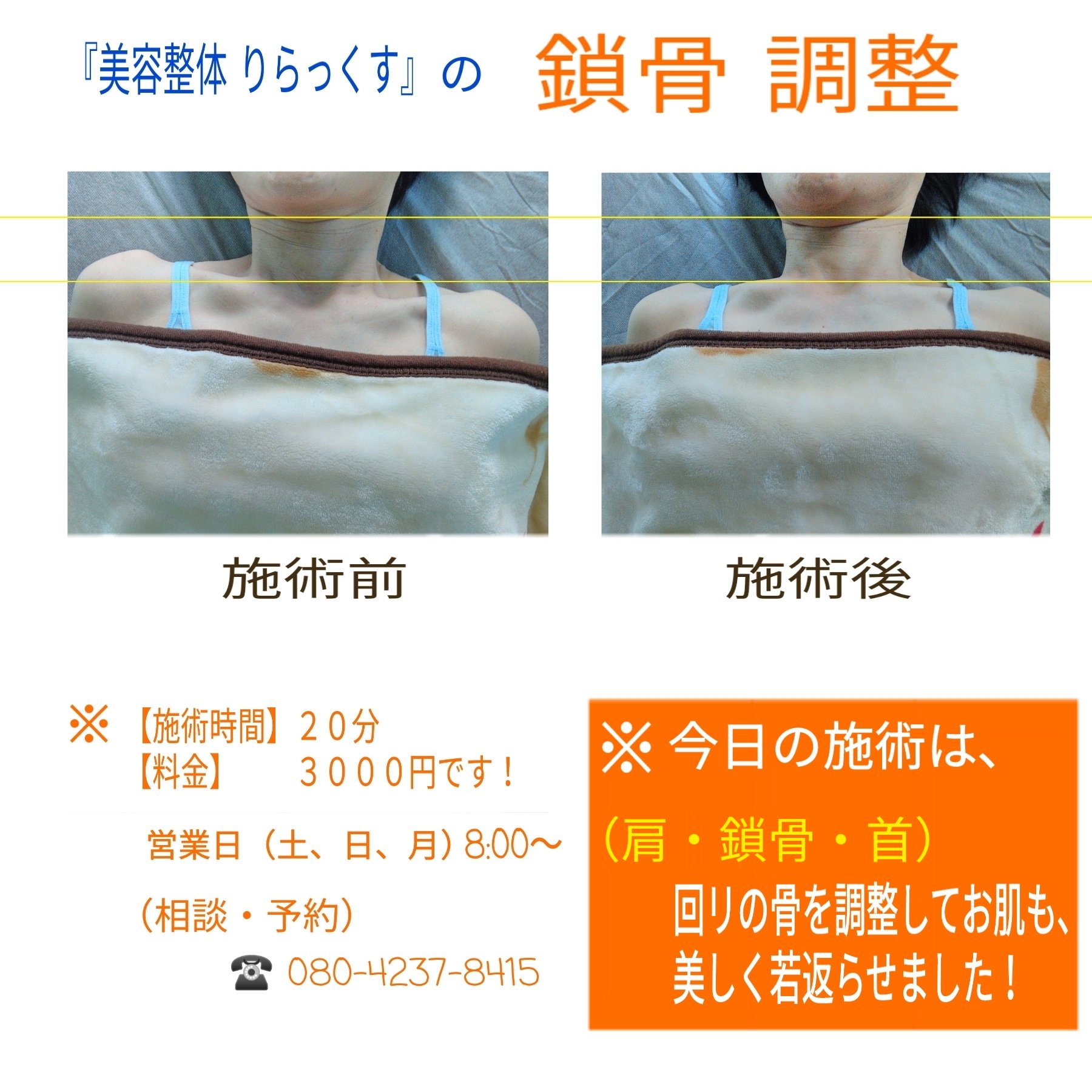 りらっくす 鎖骨美人 鎖骨美人 鎖骨フェチ 鎖骨 姿勢改善 骨盤矯正 女子 水着 水着女子 肩甲骨 肩こり解消 肩こり 頭痛 T Co Iilx4gt18g Twitter りらっくす 鎖骨美人 鎖骨美人 鎖骨フェチ 鎖骨 姿勢改善 骨盤矯正 女子 水着 水着女子 肩甲骨 肩こり解消 肩こり 頭痛 T Co Iilx4gt18g Twitter