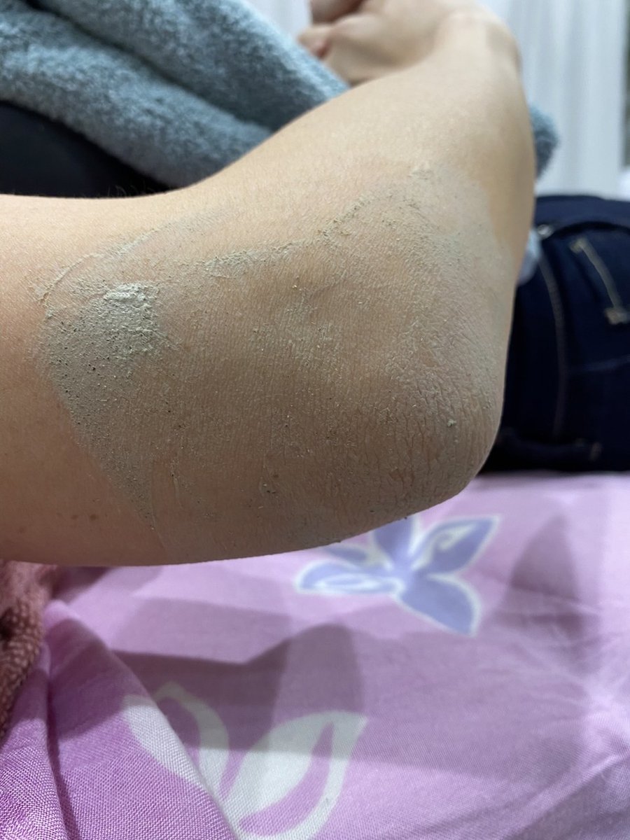 plumerista's tweet image. こんにちは!

今回は当店おススメ美肌トリートメントをご紹介致します!

ヒジ・ヒザ・背中・ヒップなどの

ざらつきを感じる部位をつるつるにしてみませんか?

施術時間はヒジ・ヒザなら20分程度となりま... 詳しくは 2su.jp/0LNl