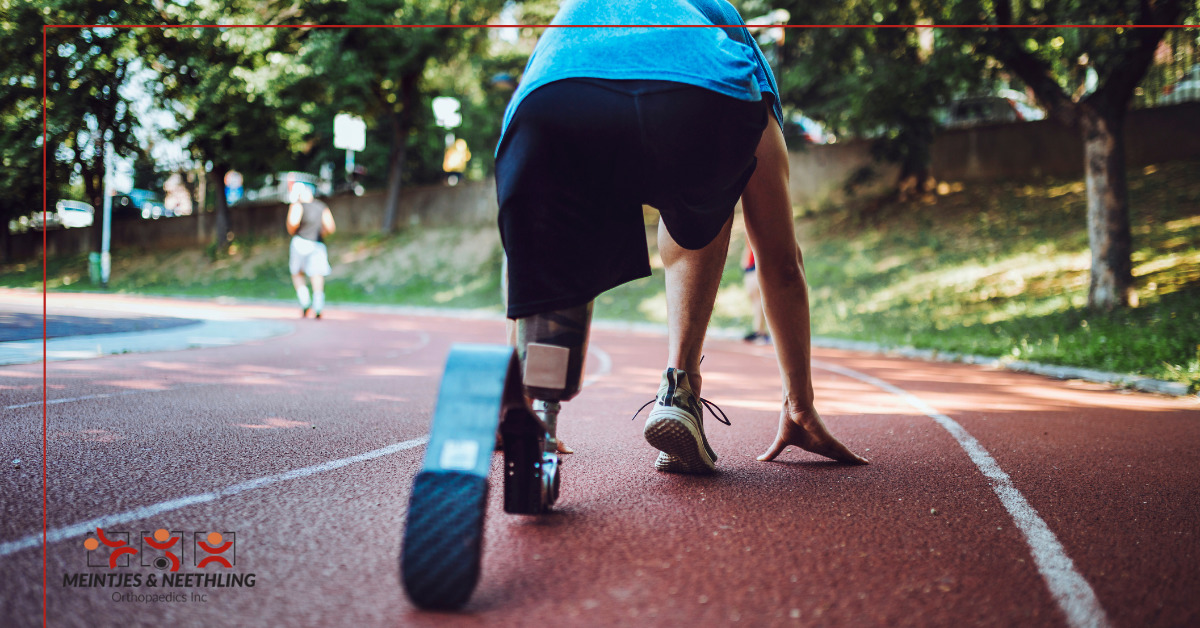 Are you someone who likes to run?

Running can be cathartic, soothing, and mentally and physically exhausting; yet, the endorphins released compensate for the difficulty.

Read our latest blog about running with a prosthetic leg here: mnortho.co.za/running-prosth…