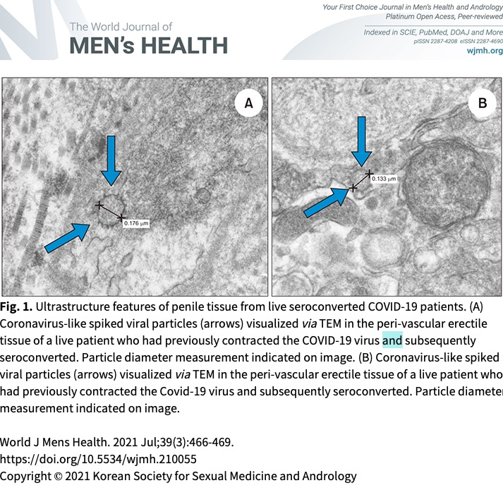 Leseerlaubnis's tweet photo. @ol_perv Not really Covid-19 is dangerous to men in various ways:
https://t.co/LbVikU3r1l https://t.co/MfzDHo0ffH