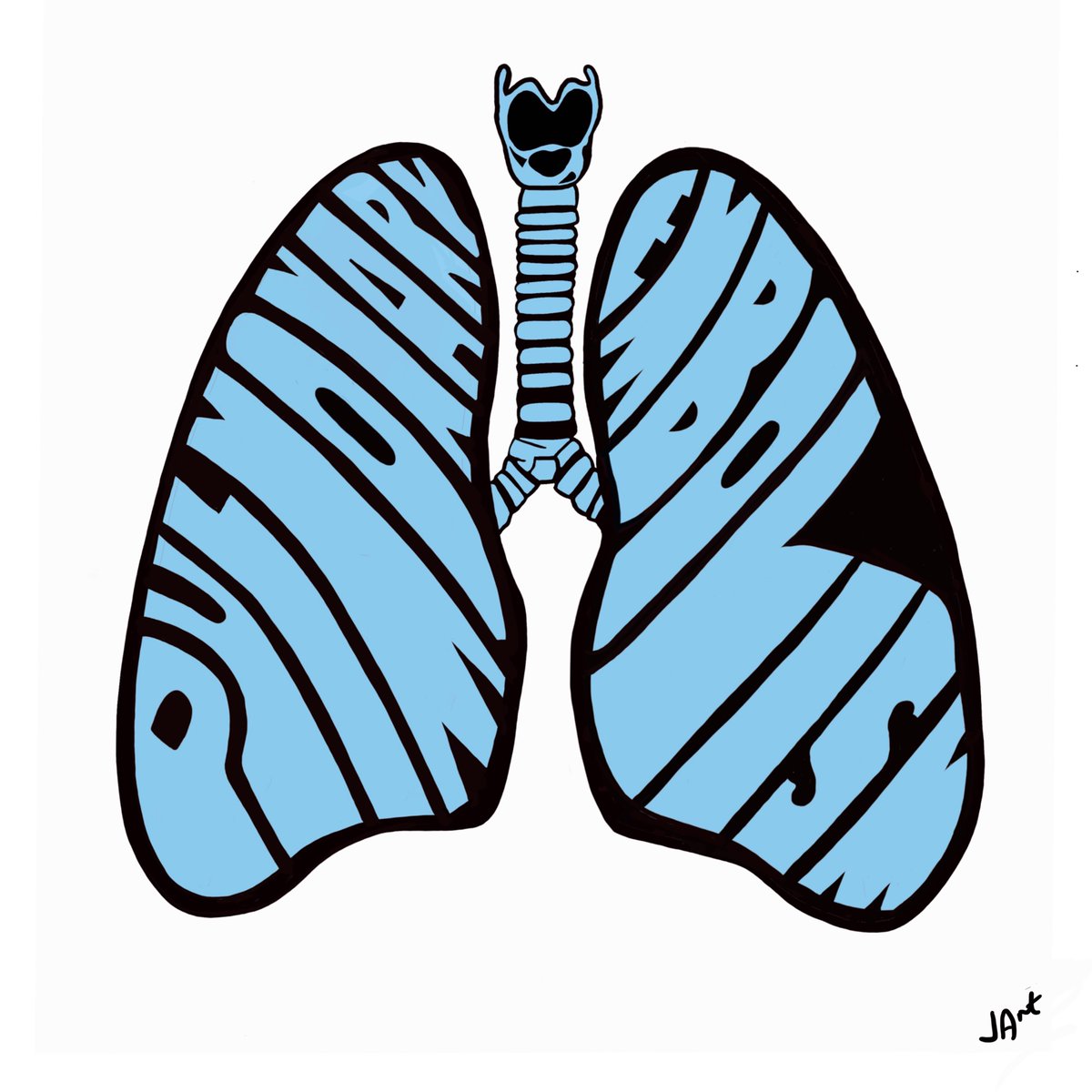 jonny_acheson's tweet photo. These #pleural #medicalart digital JPEGs are now free to download under CC to be use in #MedEd teaching
https://t.co/OABnDVYRGC
#medtwitter #RespisBest #lungs #lungart #RespEd #lung
@leicschestdoc @REvans_Breathe @BTSchair @respiratoryEDU @RespNetwork @KingsResp @RespTrainees https://t.co/fO9fZI9QOi