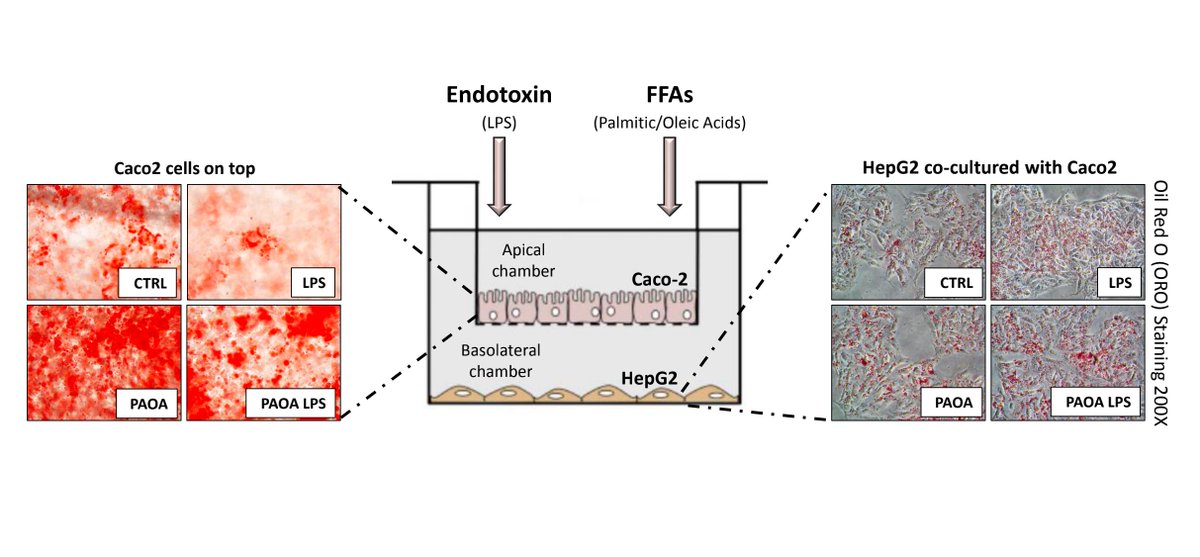 <👏Our🆕 article! Come to be the first reader~☺️>
Recreating #gutliveraxis during #NAFLD onset by
using a #Caco-2/#HepG2 co-culture system

📌#NASH #intestinalpermeability #leakygut 
Get full text from the link👉🔗mtodjournal.net/article/view/4… 🙌