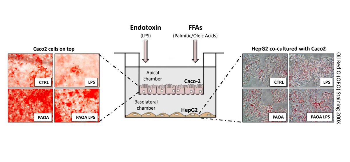MetabolismAnd's tweet photo. <👏Our🆕 article! Come to be the first reader~☺️>
Recreating #gutliveraxis during #NAFLD onset by
using a #Caco-2/#HepG2 co-culture system

📌#NASH #intestinalpermeability #leakygut 
Get full text from the link👉🔗https://t.co/HSqrYcBYmw 🙌 https://t.co/63UVEA5fIy