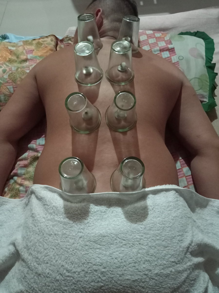 marcokolokoy's tweet photo. Satisfied client...
Massage plus ventosa...pm lang po for inquiries and for booking.. accept Home/hotel/inn service.. Davao,Panabo,Tagum and Digos City... https://t.co/afR1AQDa0J
