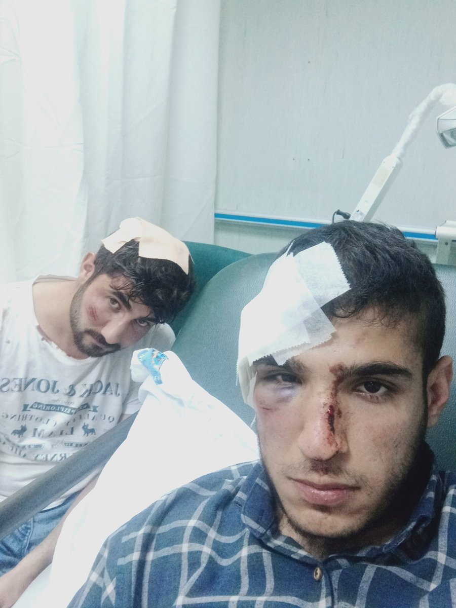 Antalya'da üniversite içinde çeteler tarafından yapılan bu saldırıya gençliğin sesi daha da yükselecek. Buradan bir kez daha söylüyoruz gençliği sindiremeyeceksiniz!
#AkdenizdeFaşistSaldırı