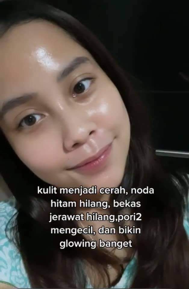 PONTIR_'s tweet photo. ✨ SERUM TERAMPUH MENGATASI JERAWAT + BEKASNYA + BOPENG ✨
👉🏻Link serumnya: https://t.co/u9dNEyA6vI
Yang udah cape ngatasin jerawat bandel wajib banget sih coba ini ‼️
Manfaat:
✨Menghilangkan jerawat, bruntusan,bopeng,minyak berlebih
✨kulit lebih cerah &amp; lembab https://t.co/UQ2MNfpNql