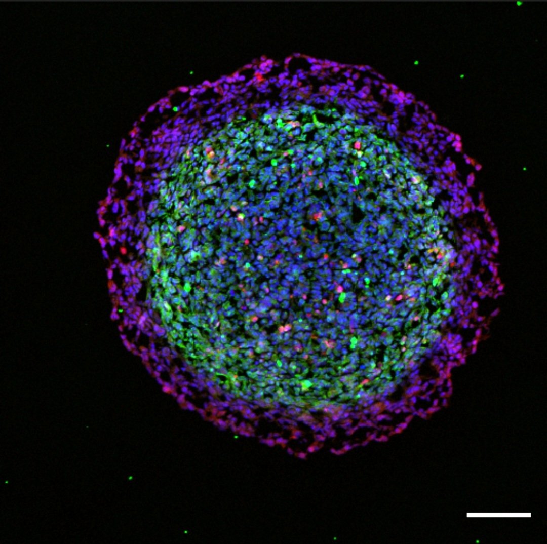 onco_hannah's tweet image. The most aesthetically pleasing experiment I&apos;ve ever done. Look at this spheroid and tell him he&apos;s beautiful 😍