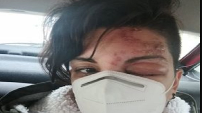 viaggrego's tweet photo. #Catanzaro: grave #Reazione #Allergica dopo la #TerzaDose di #Vaccino, ricoverata per #Covid ! https://t.co/6iYiURi4ab https://t.co/vDboq8hE9h