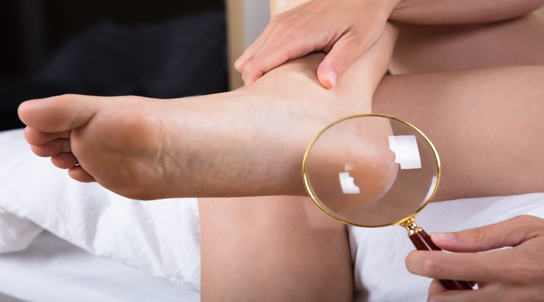 Discover what you need in your diabetic foot care plan! bit.ly/3sPKH0m