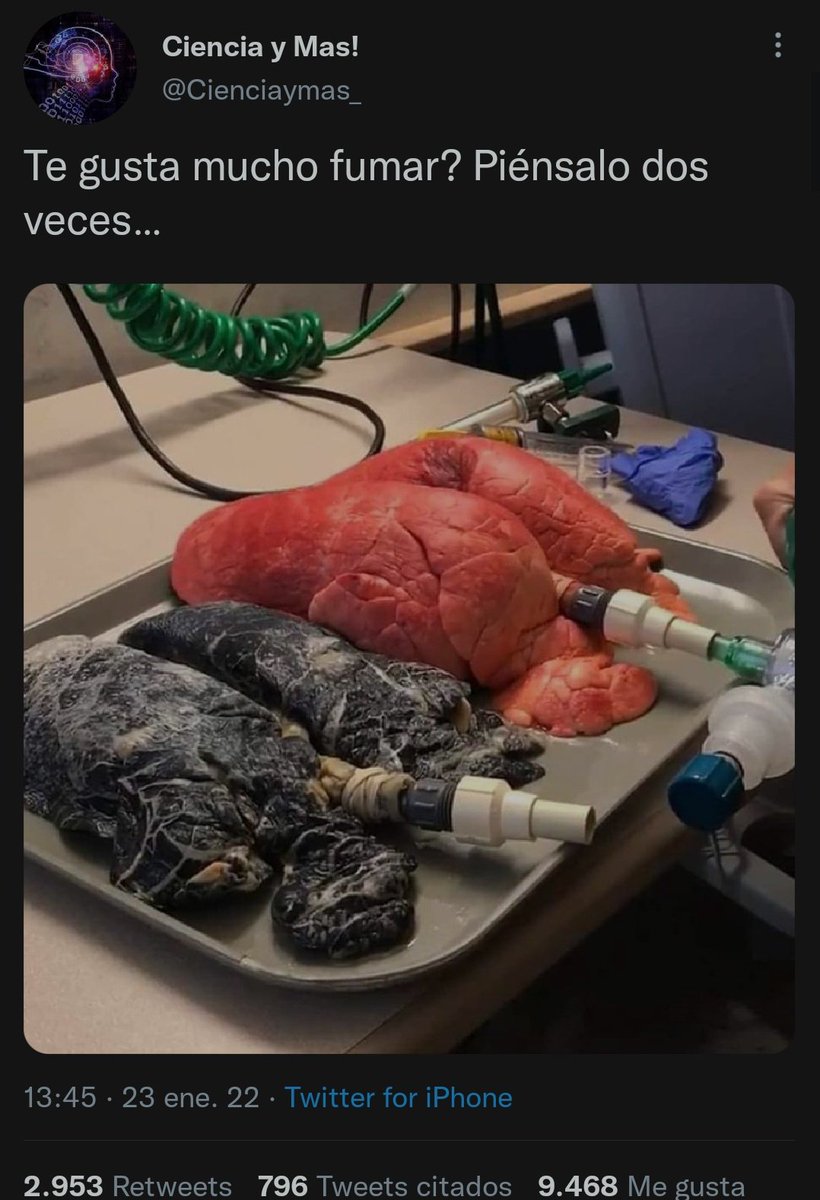 pbm04_'s tweet photo. https://t.co/U4T5Nkrd6u