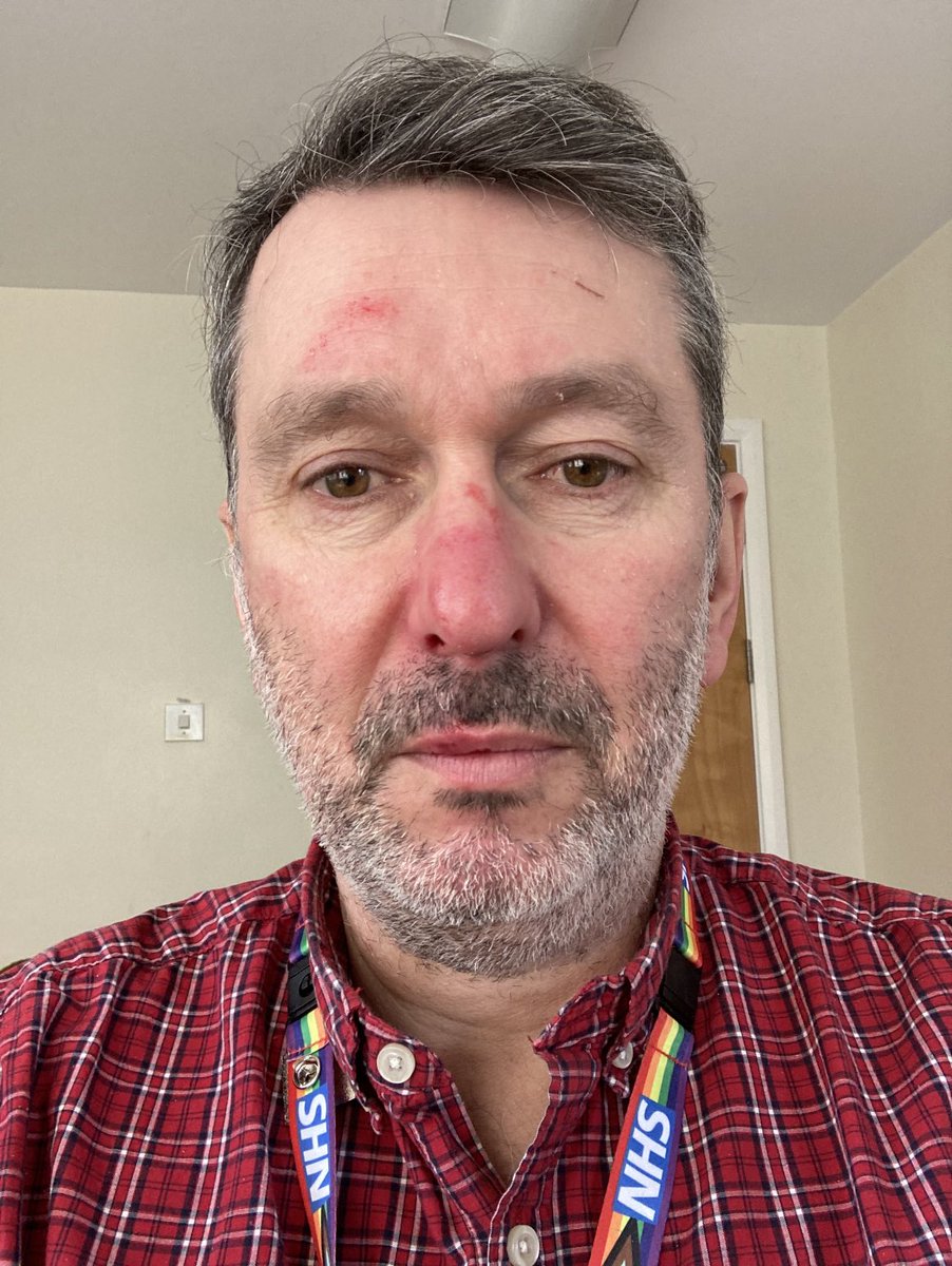 ClensyStuart's tweet photo. Running 2 mins late for a meeting, falling face first and missing the first 20mins #morehastelessspeed https://t.co/MLPszXWSTb