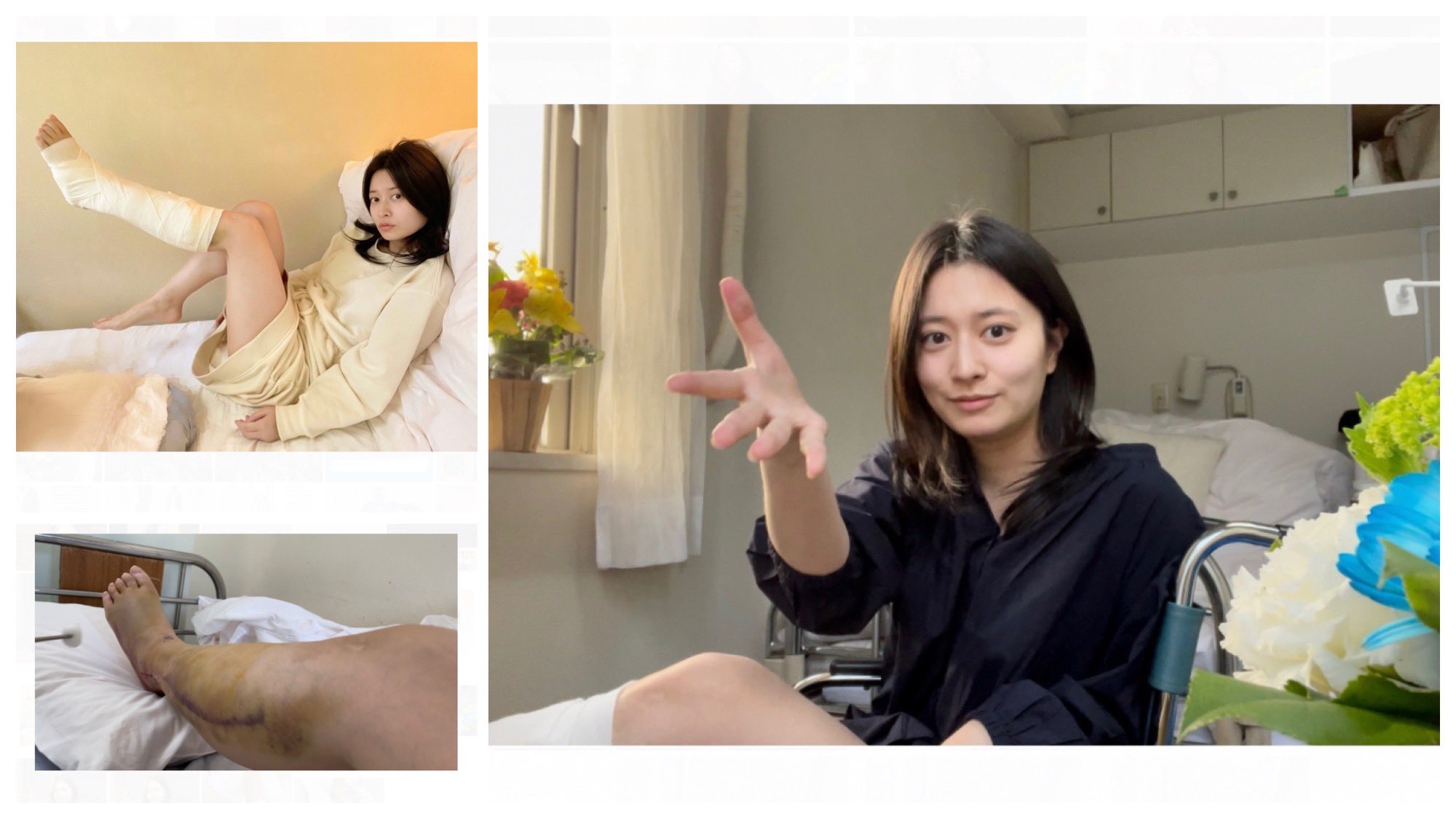 後藤 郁 オフィシャルyoutube更新 ご報告 後藤 骨折したってよ 入院初日 怪我などの説明 編集ふざけ倒してるので是非ww 後藤骨折したってよ かおるの骨折日記 T Co G65mjktqdr T Co Bnhdmmpgqo Twitter 後藤 郁 オフィシャルyoutube更新 ご報告 後藤 骨折したってよ 入院初日 怪我などの説明 編集ふざけ倒してるので是非ww 後藤骨折したってよ かおるの骨折日記 T Co G65mjktqdr T Co Bnhdmmpgqo Twitter