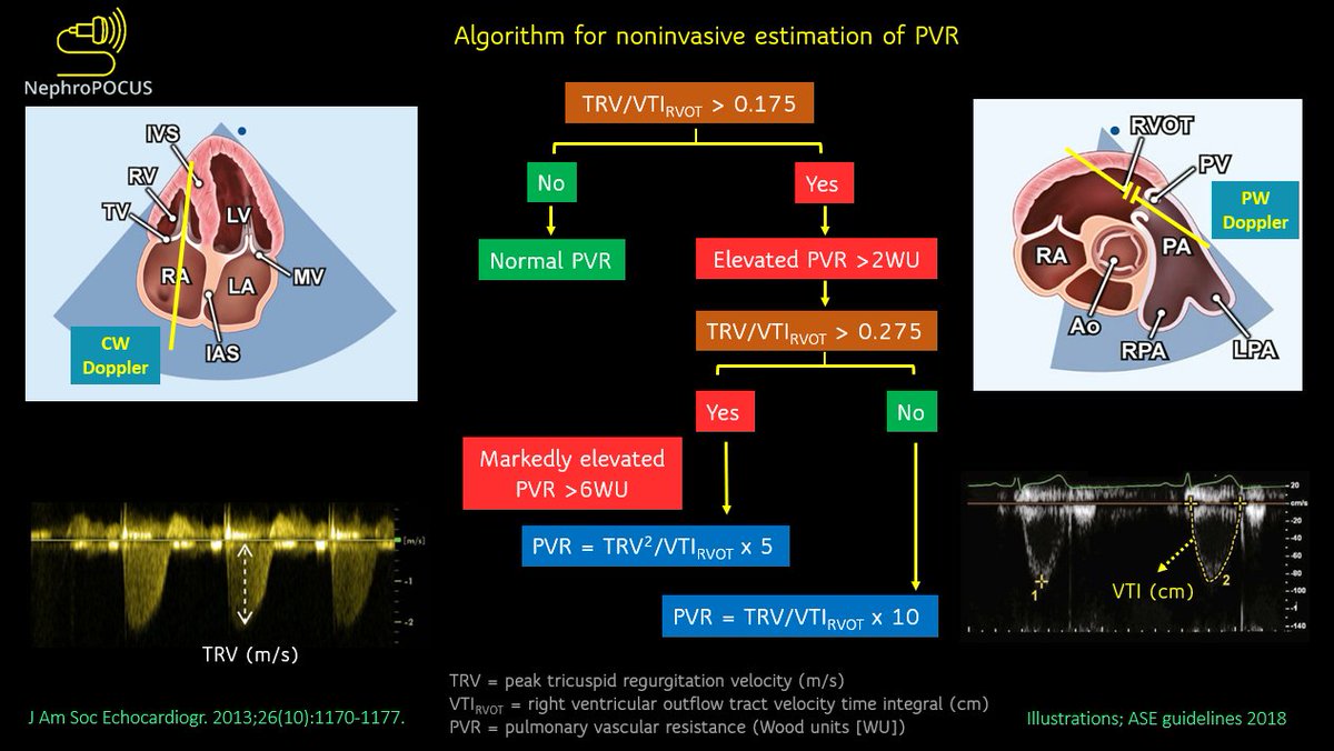 NephroPOCUS tweet media