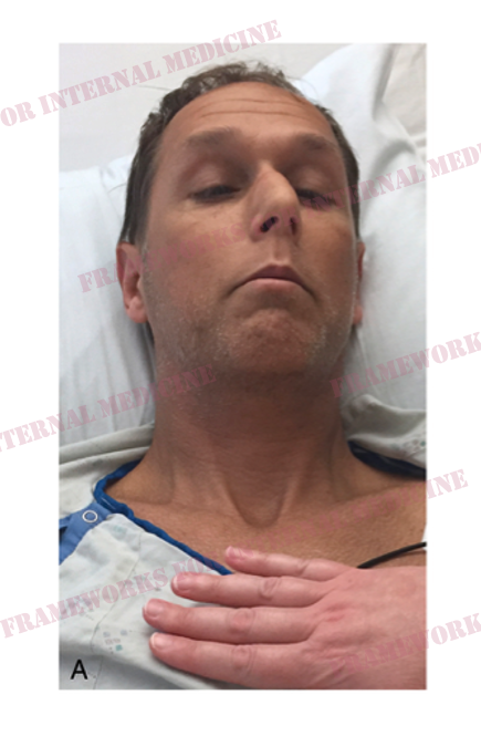 André Martin Mansoor tweet media