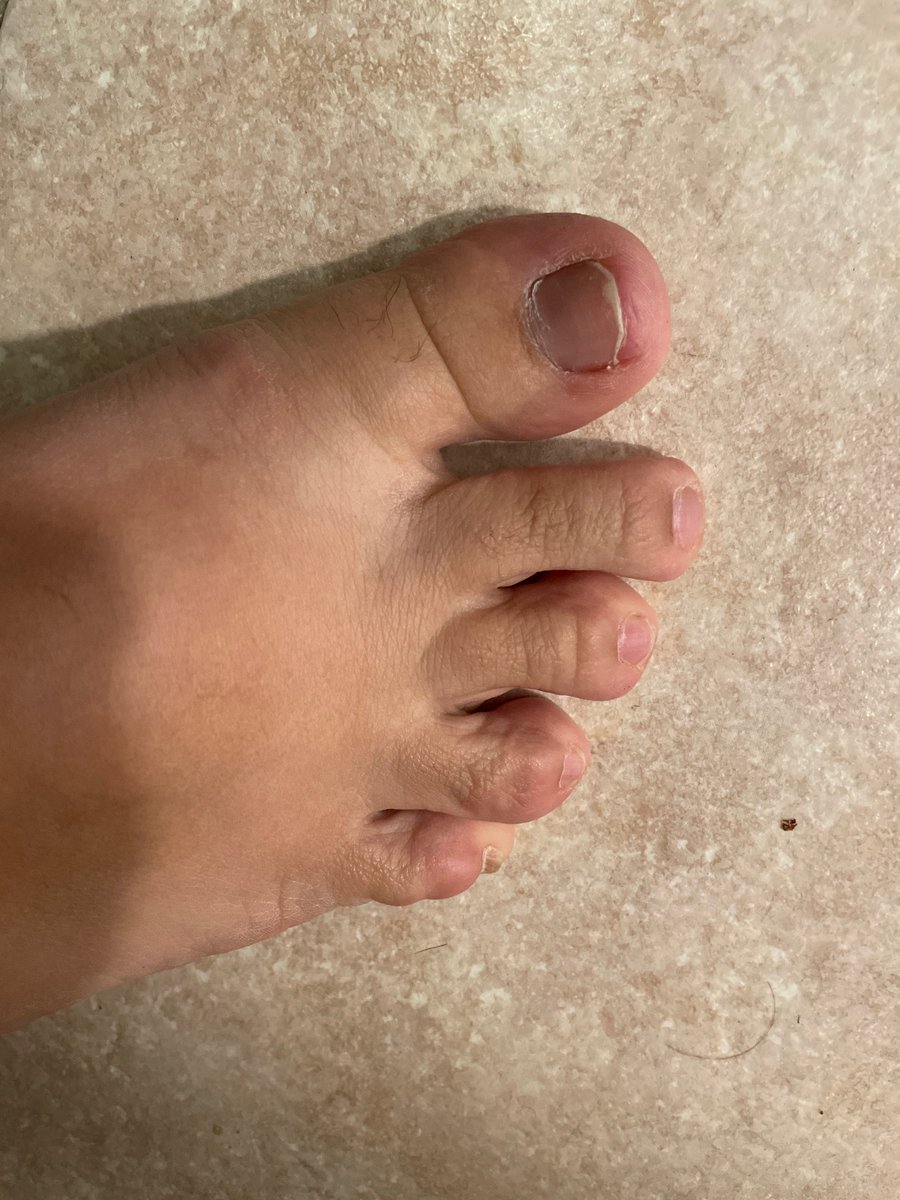 justokayfetz's tweet photo. My little piggies need some love!!! I need a pedicure so bad!!!!  #feetpigs #feetworshi̇p https://t.co/PnPELFwMeh