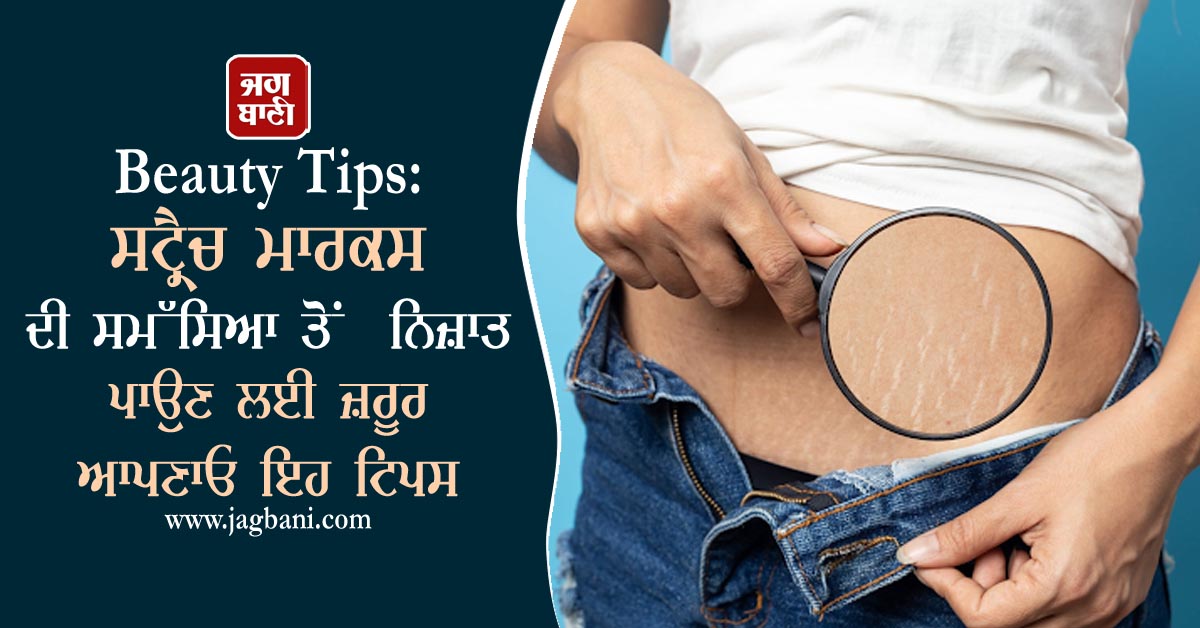 JagbaniOnline's tweet photo. Beauty Tips: ਸਟ੍ਰੈਚ ਮਾਰਕਸ ਦੀ ਸਮੱਸਿਆ ਨਿਜ਼ਾਤ ਪਾਉਣ ਲਈ ਜ਼ਰੂਰ ਆਪਣਾਓ ਇਹ ਟਿਪਸ
https://t.co/n79jWrfBmf
#BeautyTips #SomeTips #Help #StretchMarks https://t.co/ST7kvjXnjm