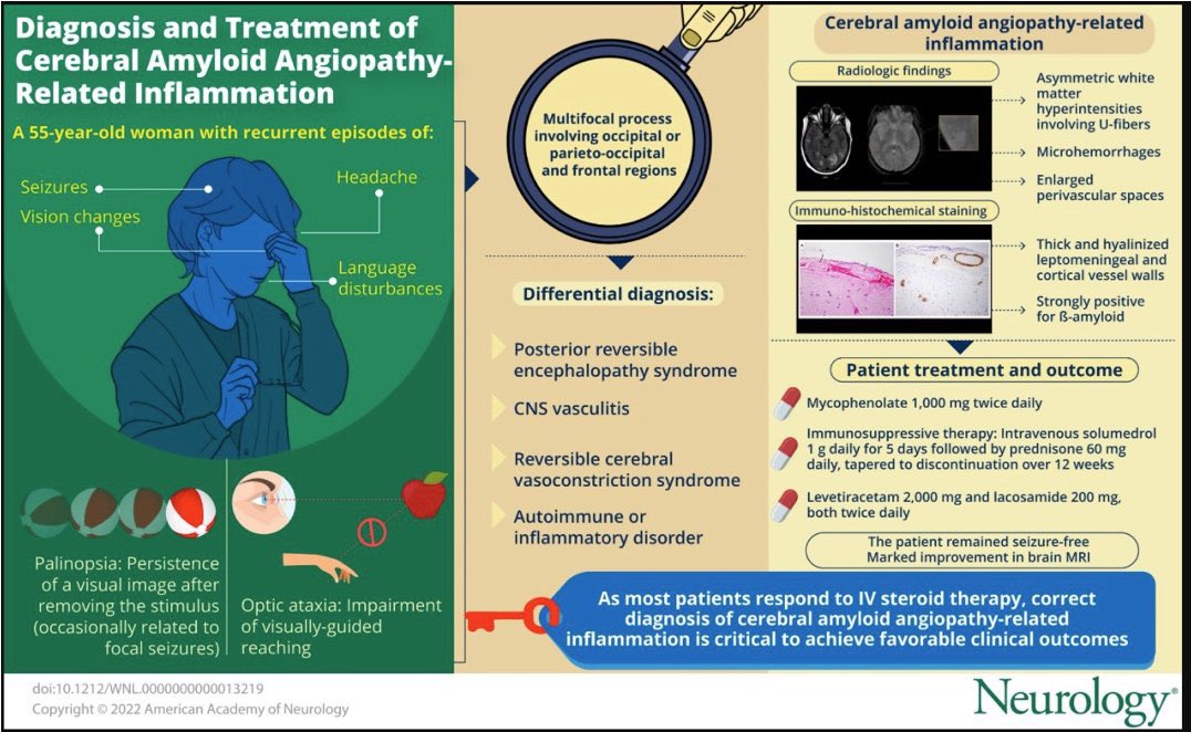 Great case and review on CAA-ri in @GreenJournal by our very own @VJeanneretl Check out the full case here: n.neurology.org/content/98/8/3… @EmoryNeurology @EmoryNeurohosp1 @RebeccaFasanoMD @HuttoSpencer @ShaerQasem @DineshJillella @Nirav_r_bhatt @gabrielabou94 @VizcarraJA