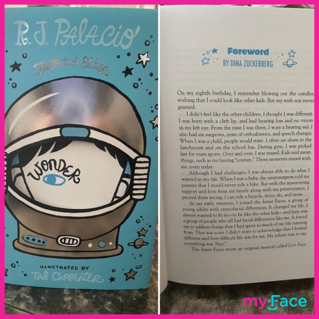 myFace (@myfaceorg) on Twitter photo The illustrated edition of <a href="/RJPalacio/">RJ Palacio</a> #Wonder is here! We're so proud of our Director of Family Programs, Dina Zuckerberg, who wrote the foreword of the novel & got to share her incredible journey of living with a facial difference! Get your copy today at tinyurl.com/w6vxeb4k! The illustrated edition of <a href="/RJPalacio/">RJ Palacio</a> #Wonder is here! We're so proud of our Director of Family Programs, Dina Zuckerberg, who wrote the foreword of the novel & got to share her incredible journey of living with a facial difference! Get your copy today at tinyurl.com/w6vxeb4k!