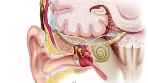 isitmedernek's tweet photo. @ASHB_COCUK @tcailesosyal @sesric Önceden beyin sapı implant ameliyatları tamamen karşılanırken 100 bin TL küsur ilave ücreti bulamayan çocuklarımız ameliyat olamıyor (Devlet ödemesi 71600) çocukların sağlık hakkı ihlal ediliyor! @ECHA_Turkey @drorhankoc @deryayanikashb @tcailesosyal @ashb_eyhgm @EngTuketiciHak https://t.co/1NTqo9OWC9