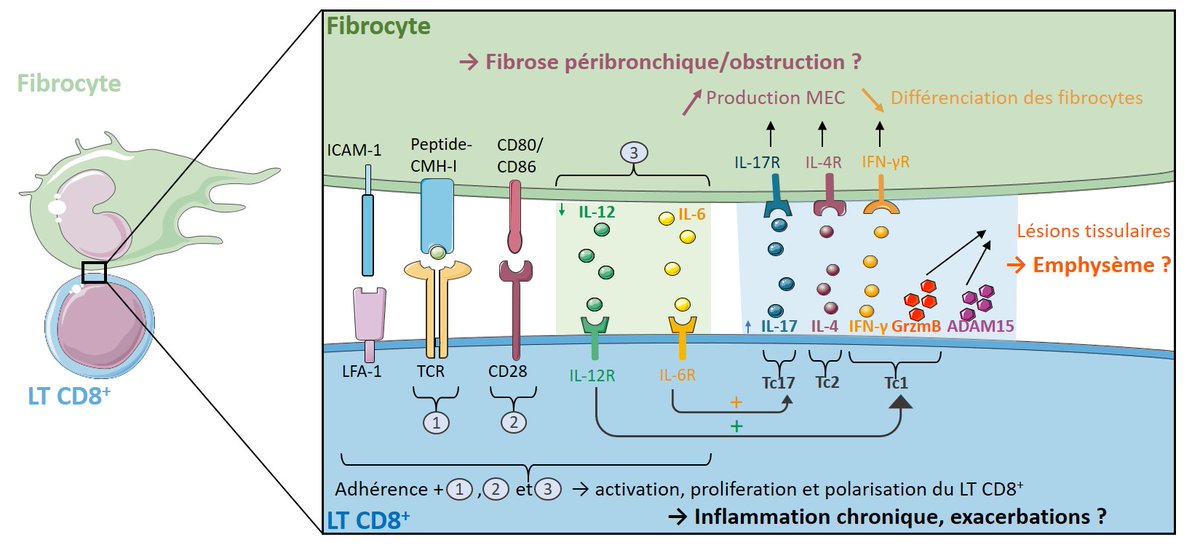 DupinIsabelle's tweet photo. "Lymphocytes T CD8+ et fibrocytes : un jeu dangereux dans les bronches distales des patients atteints de bronchopneumopathie chronique obstructive": une jolie revue en français, qui introduit le projet de thèse d'Edmée Eyraud:
https://t.co/Hxv6VTb7wV
#COPD #LungScience https://t.co/Tk0cwnVVsN