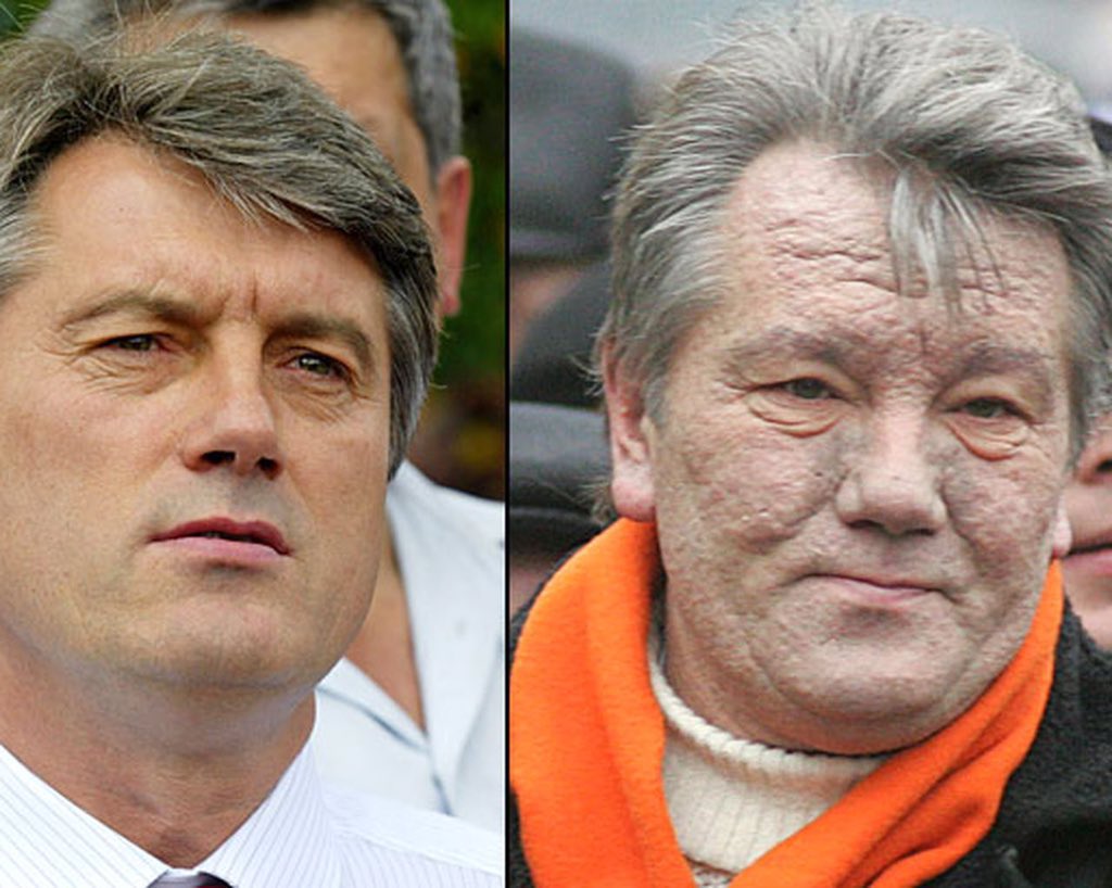 Julian Roo on Twitter: "Para todos los que aman a Putin: Les recuerdo que  este es Viktor Yushchenko, fue envenenado por Putin con dioxin cuando fue  candidato en el 2004, era pro