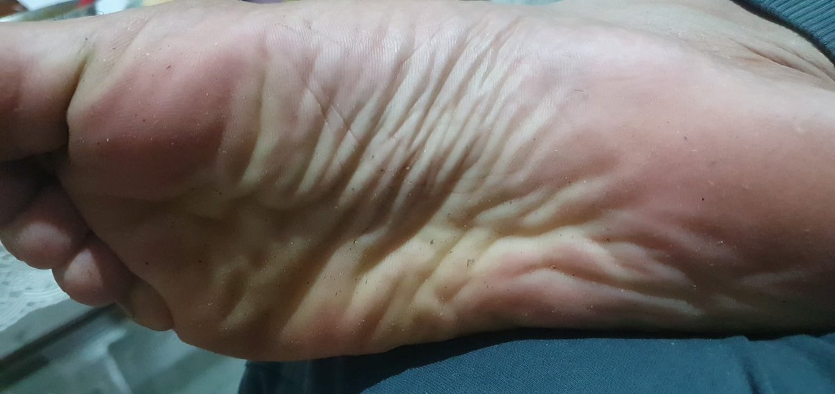 MasterOfYou6's tweet photo. Dirty smelly feet 🤮 But heaven for you piggies 😂 Dm me to worship them 🐷

#paypig #cashcow #cashmaster #alphamaster #findom @slavekane @FindomRT8 @weakandpathetic @RtPiggy79k https://t.co/4xFQ4WZabm