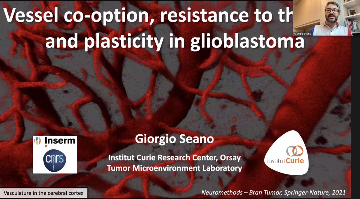 ZanivanLab's tweet photo. And with @GiorgioSeano we move from CAFs to Vessel co-option #EACRstructuralmicroenvironment @EACRnews. Beautiful images! https://t.co/eOILI9kvNt