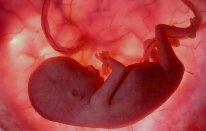 pemarcelojpa's tweet photo. A CIÊNCIA também diz que essa imagem representa UMA VIDA DE 24 SEMANAS! Onde estão os defensores da ciência também aqui?
O homem de fé sempre cultiva a equivalência do que é Verdadeiro, ele não pode fazer escolhas narrativas que defendem só o que lhe satisfaz! 
#naoaoaborto https://t.co/SIs9m7lQGD