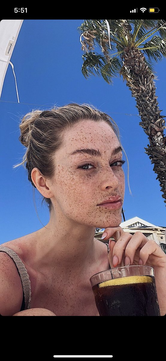 mhrayy's tweet photo. Look at those freckles tho 🥺🥺 https://t.co/EDaZvjARpA