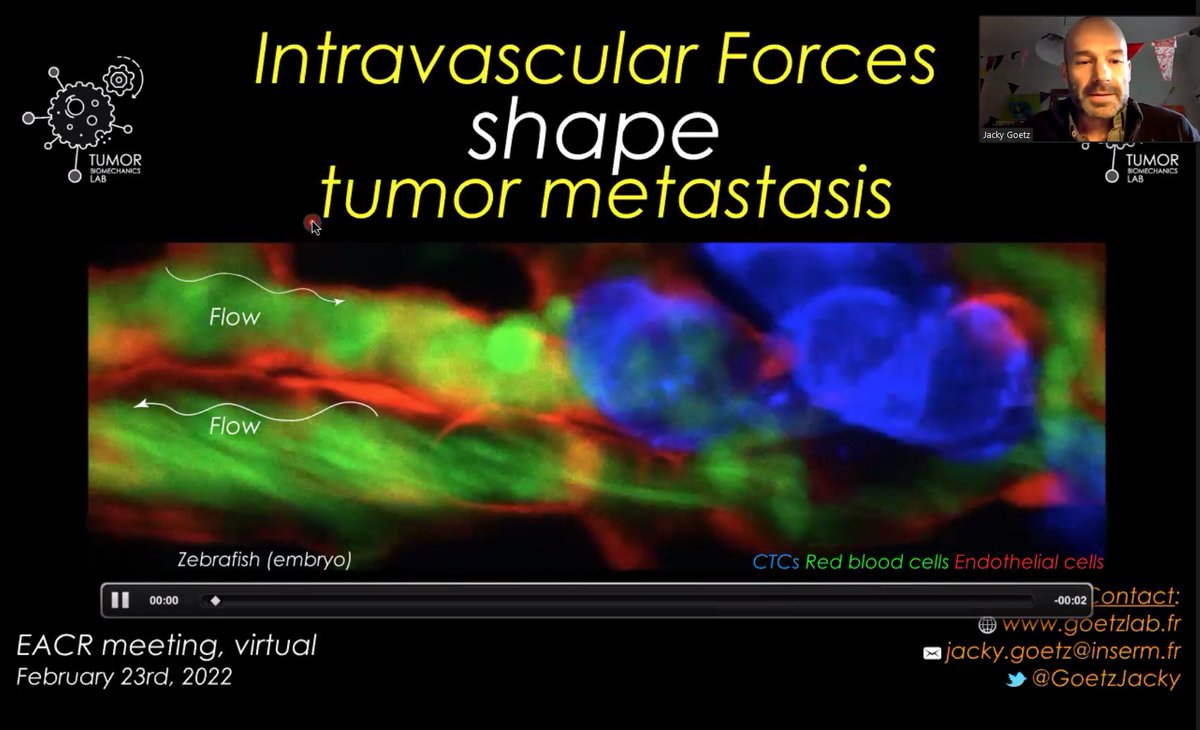 ZanivanLab's tweet photo. Our co-organiser of the #EACRstructuralmicroenvironment @GoetzJacky on the stage. We are diving inside the tumour thanks to amazing intravital imaging! @EACRnews https://t.co/oF1ztVrTvW