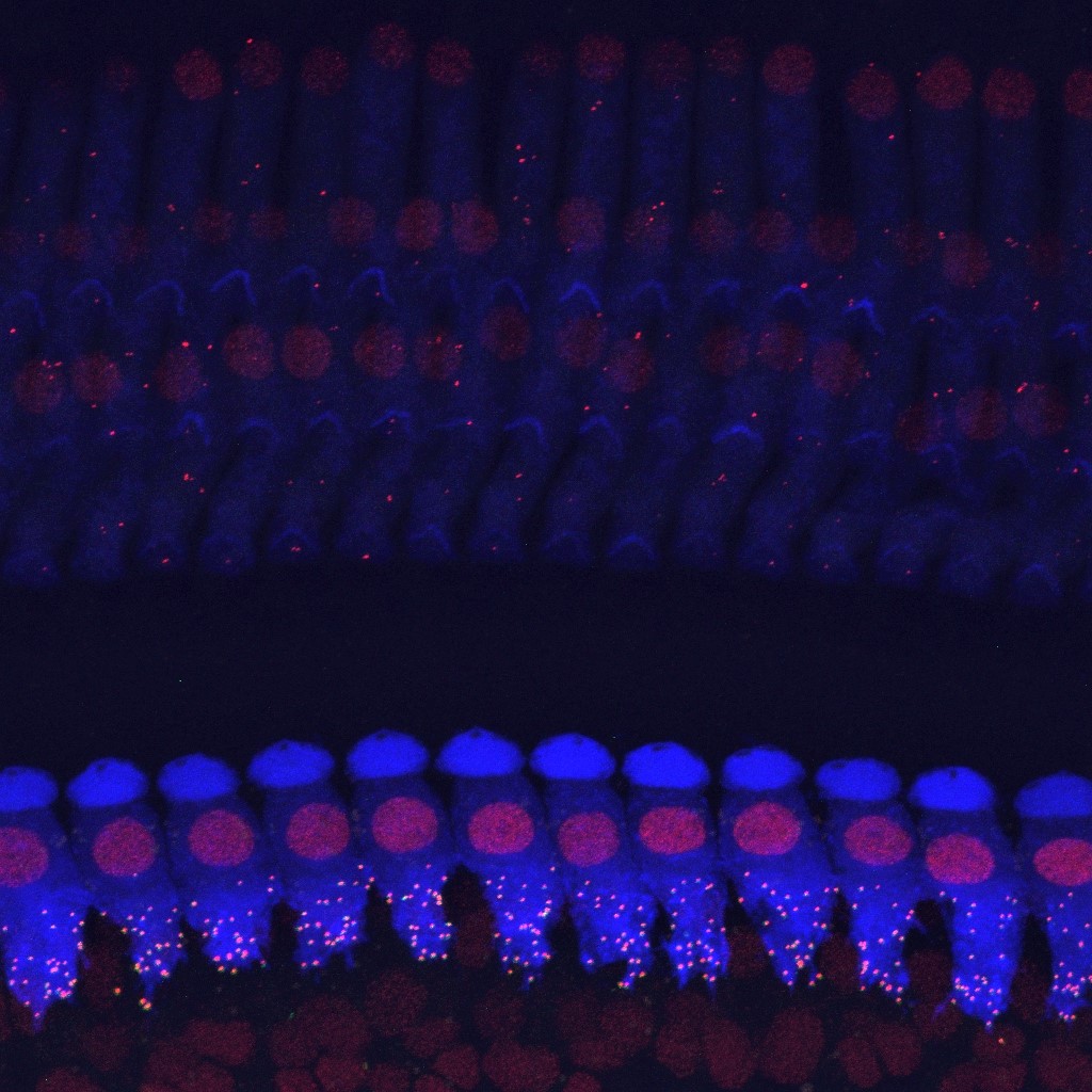 Aravind Parthasarathy tweet media