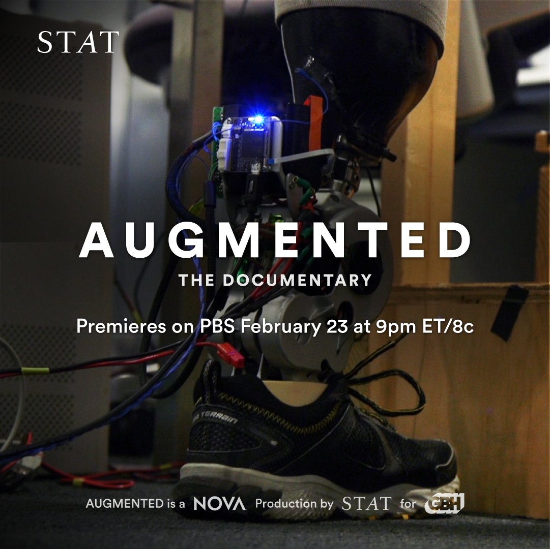 rickberke's tweet photo. WSJ review @statnews "fascinating'' film #AUGMENTED tonight 9 ET @novapbs: "It’s science-fiction, except it’s not fiction and the science is made utterly accessible.''
Congrats @Matthew_Orr @heathermac20 @GideonGil @DominicSmithy @Linda_Pizzuti 
https://t.co/znKC0fP3FR via @WSJ https://t.co/FcKNT9eV8P