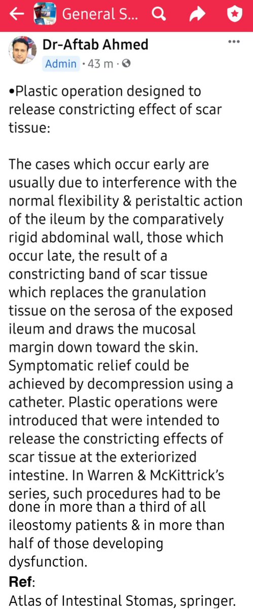 DRAFTABAHMED7's tweet photo. Plastic operation designed to release constricting effect of scar tissue:
𝗥𝗲𝗳: Atlas of Intestinal Stomas, springer.
#Stoma #ileostomy #colostomy #GITwitter #MedTwitter #colorectal 
#intestinalobstruction
#Exploratorylaparotomy https://t.co/NBGRVKpuQ0