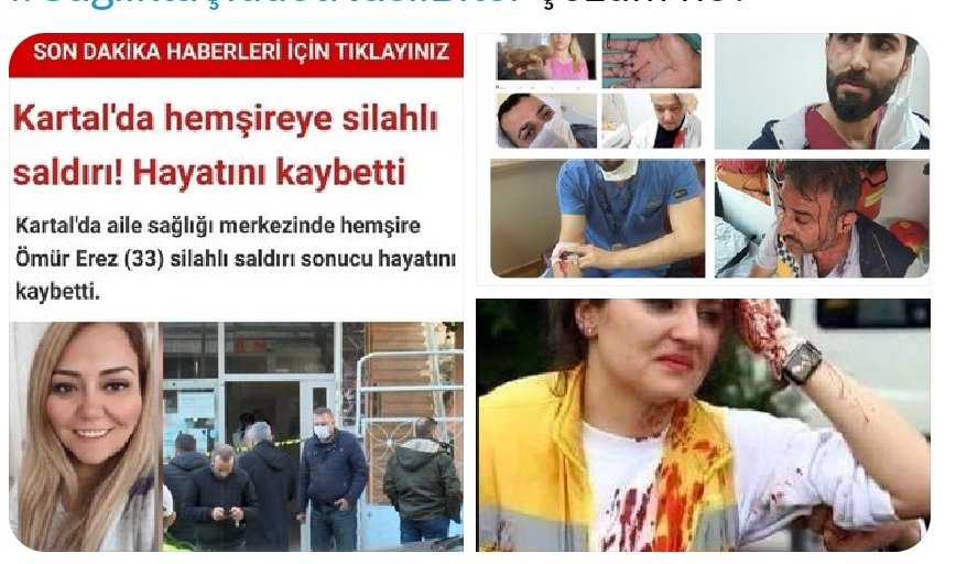 Sağlıkta Şiddet göstren
1)5yıl ücretsiz sağlıktan men edilsin
2)Maddi manevi tazminat ödesin
3)1yıl ücretsiz kamu hizmeti versin
4)Kamu malına verdiği zararı hemen ödesin
5)En az 6yıl hapis cezası alsın
6)Sisteme"ŞİDDET SABIKA"geçsin
Ya da"TERÖR SUÇU"sayılsın
#SağlıkSistemiEntübe